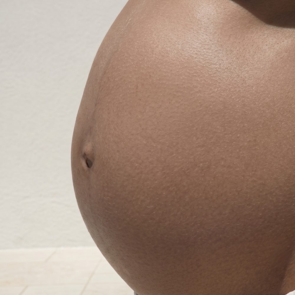 Pregnant belly with dry skin, before applying Bump Butter